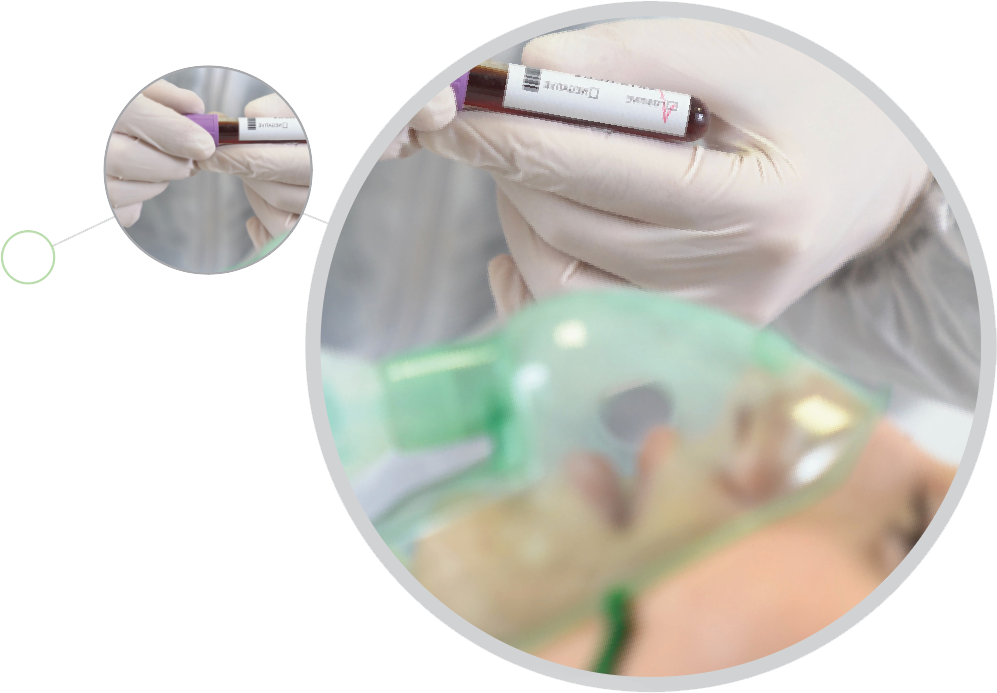 Ventilator Monitoring